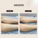 아나덴 슈가링왁싱 파주운정역점