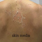 스킨메디아