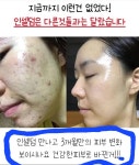 용인성공동안샵