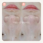 더맑은스킨 평택고덕점