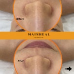 마인힐에스테틱 안양범계점