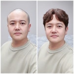 맞춤가발 모담 남성전용