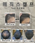 보아스헤어샾