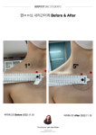 대전체형교정 밸런스핏