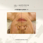 제이메디스킨