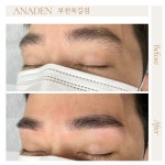 아나덴 슈가링왁싱 부천옥길점