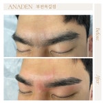 아나덴 슈가링왁싱 부천옥길점