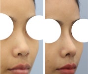 더좋은성형외과의원