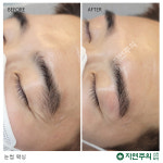 자연주의 스킨&슈가링왁싱