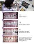 뉴이온치과기공소