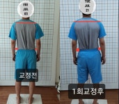 주약손체형교정명가