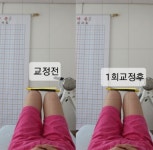 주약손체형교정명가