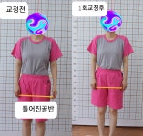 주약손체형교정명가