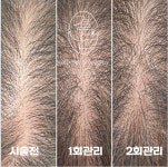 결나다