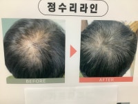 제이와이피이헤어스토리