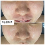 더좋은피부
