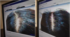 웰킨두피탈모센터 천안신불당점