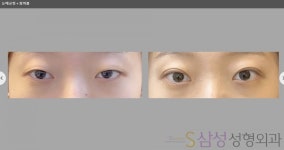 S삼성성형외과의원
