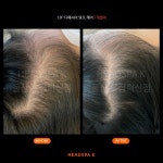 헤드스파K 울산우정혁신점