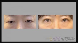 S삼성성형외과의원
