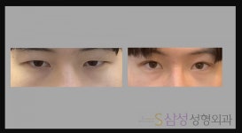 S삼성성형외과의원