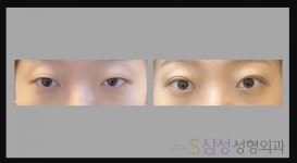 S삼성성형외과의원