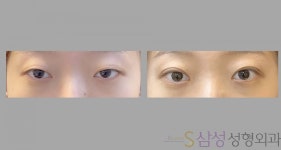 S삼성성형외과의원