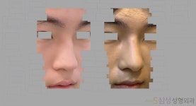 S삼성성형외과의원
