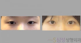 S삼성성형외과의원