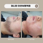 아나덴 슈가링왁싱 인천부평역점