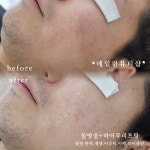 에일린뷰티샵 속눈썹브로우바피부 울산달동점