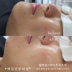 에일린뷰티샵 속눈썹브로우바피부 울산달동점