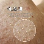 마이온스킨