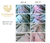 수아랑스킨케어