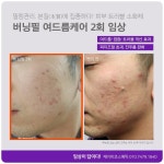 더고운피부관리