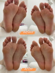피부앤속눈썹story