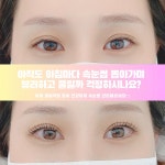 디어영뷰티(Dear young beauty) | 디어뷰티 속눈썹&눈썹&페이스왁싱