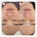 더맑은스킨 평택고덕점