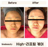 라임뷰티