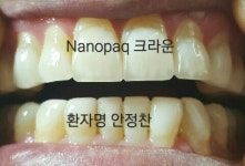 찬스덴탈