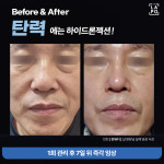 예뻐지는샵