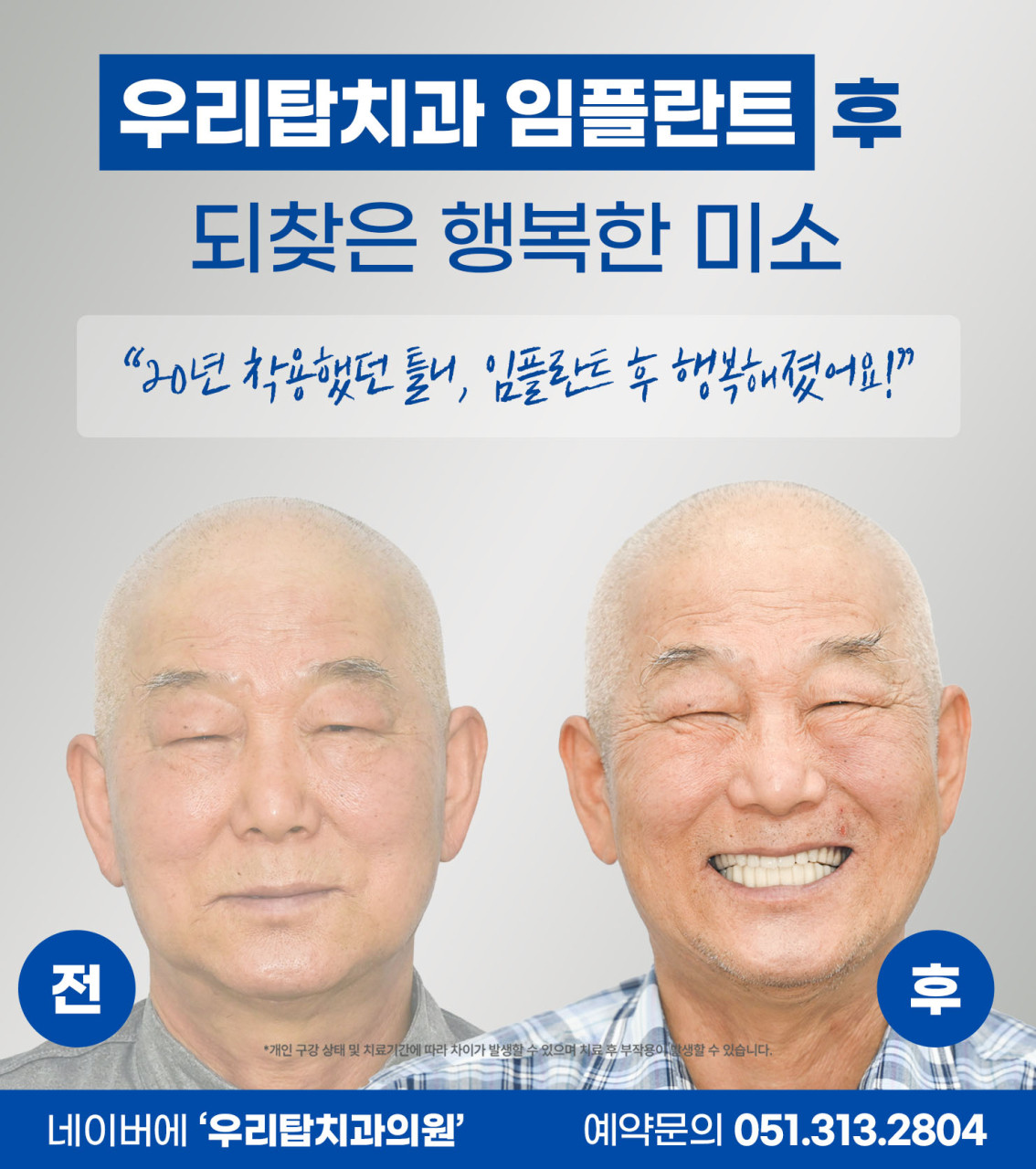 우리탑치과의원 광고