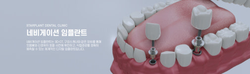 스타플란트치과의원