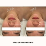 러브수에스테틱