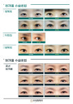 에이치성형외과의원