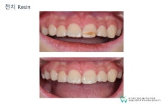 웰치과의원 성남