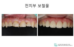 웰치과의원 성남