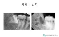 웰치과의원 성남