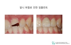 웰치과의원 성남