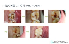 웰치과의원 성남